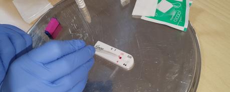 Für den HIV-Test werden nur wenige Tropfen Blut benötigt Testdurchführung